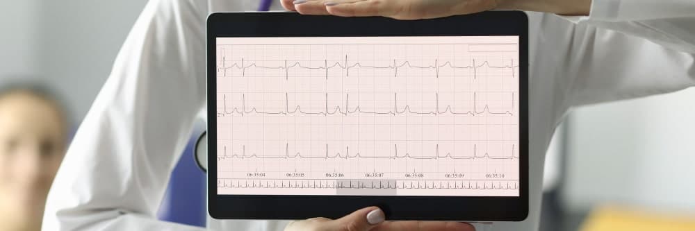 what is heart rate variability
