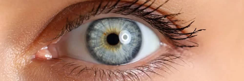seeing yellow spots in vision
